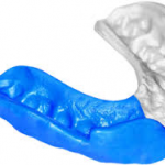 MOUTHGUARDS