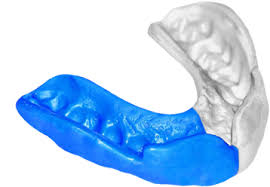 mouthguard