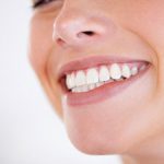 Tooth Whitening